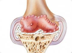 保护骨关节原料推荐